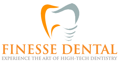 Finesse Dental - Logo