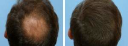 Central Florida Hair Restoration - Logo