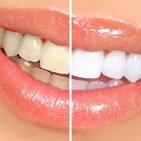 Clinica Dental Hotz - Logo