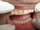 Progreso Dentist Mexico - Logo