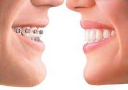 The Brace Place - Logo